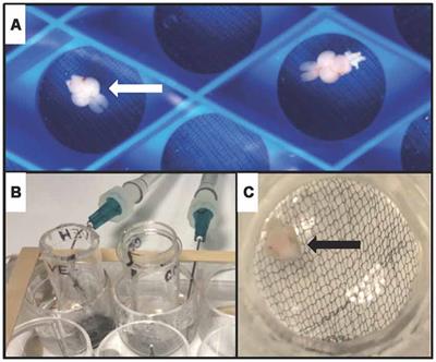 Cholinergic Stimulation of the Adult Zebrafish Brain Induces Phosphorylation of Glycogen Synthase Kinase-3 β and Extracellular Signal-Regulated Kinase in the Telencephalon